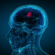 Solid Tumor Evaluation & Treatment
